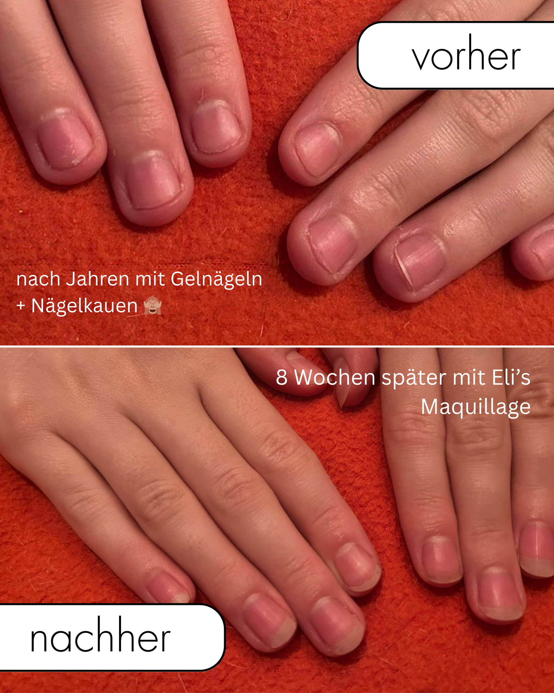 Beige Minimalist Beauty Before After Collage Instagram Post.zip - 1.png